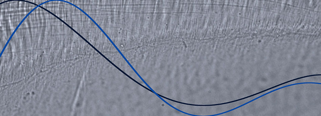 Nanopores underlie our ability to tune in to a single voice