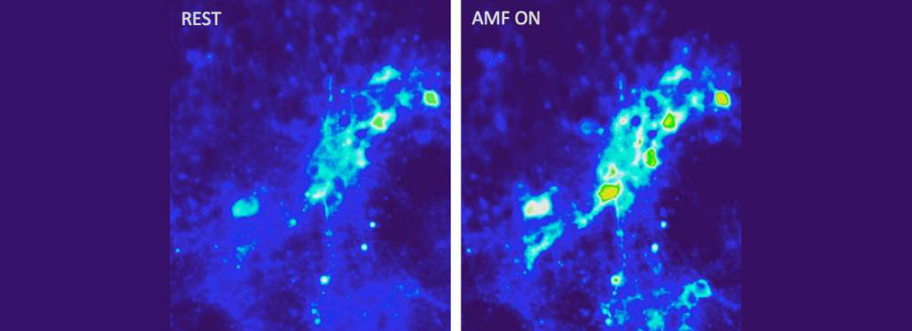 Magnetic brain stimulation