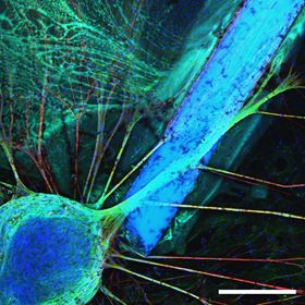 Scaffold shape gets nerve cells into the groove