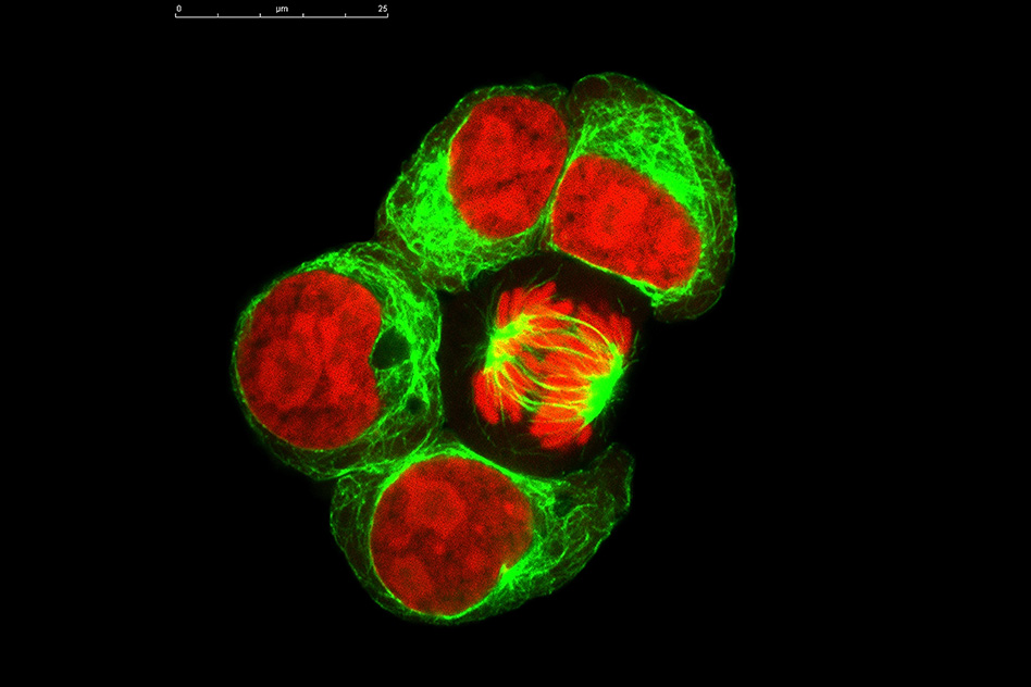 Gene circuits in live cells can perform complex computations