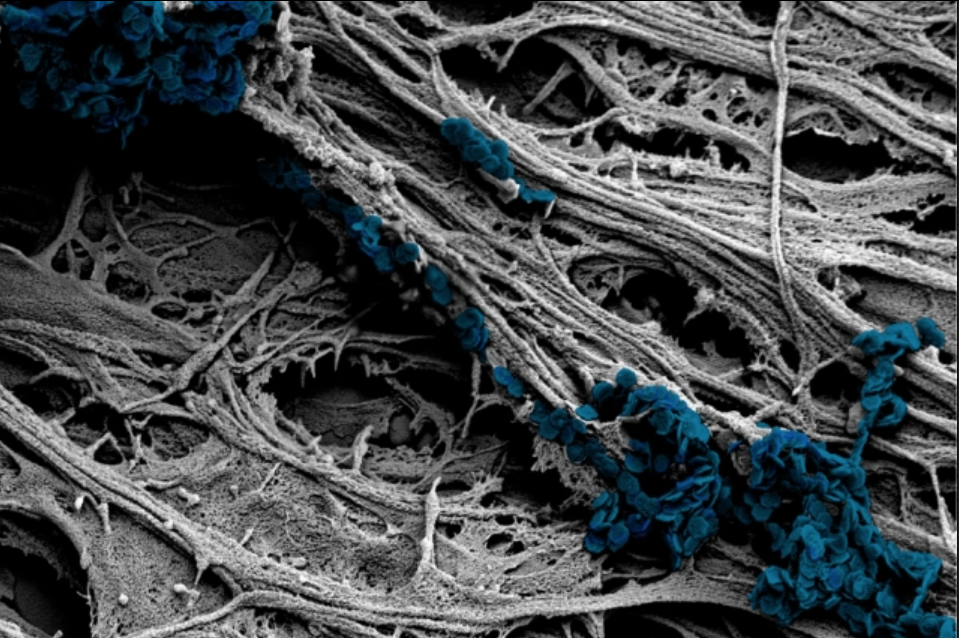 A mechanical way to stimulate neurons