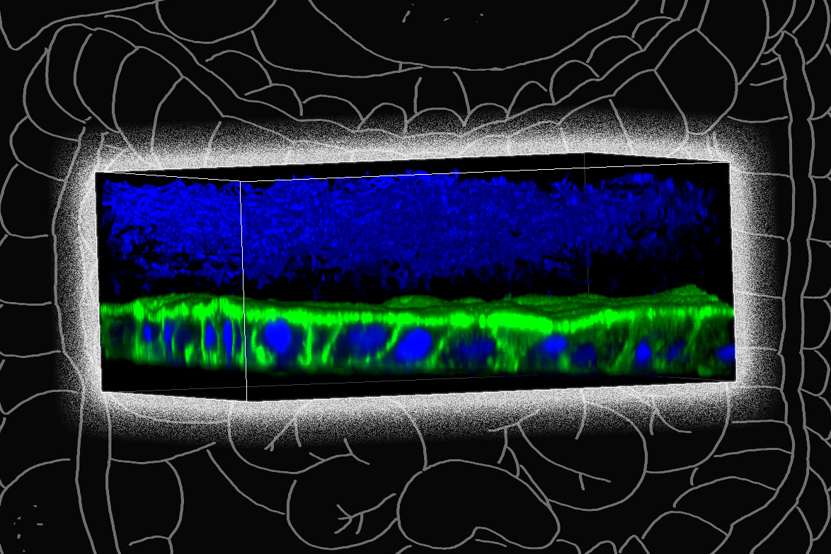 A new tool for modeling the human gut microbiome