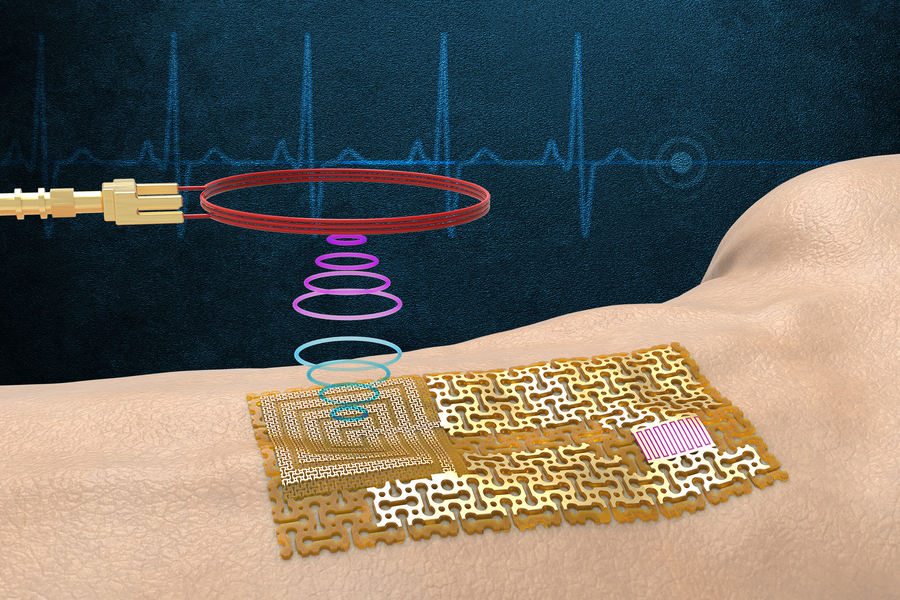 Engineers fabricate a chip-free, wireless electronic “skin”