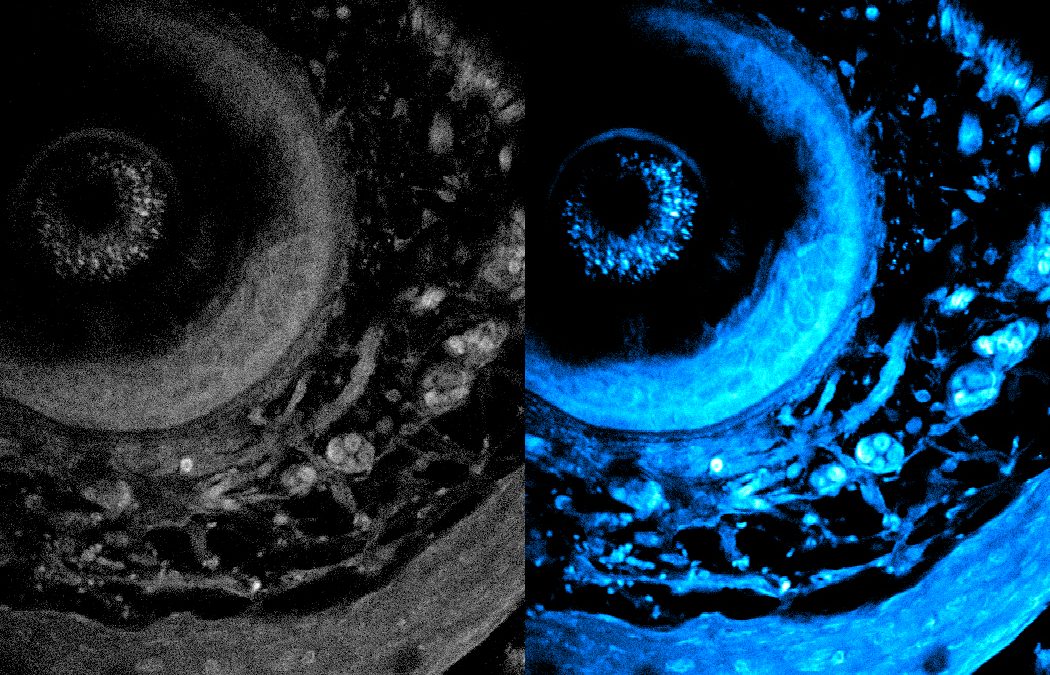 Deep and dynamic metabolic and structural imaging in living tissues