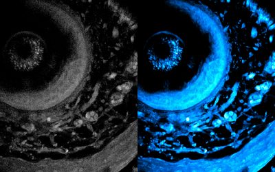 Deep and dynamic metabolic and structural imaging in living tissues